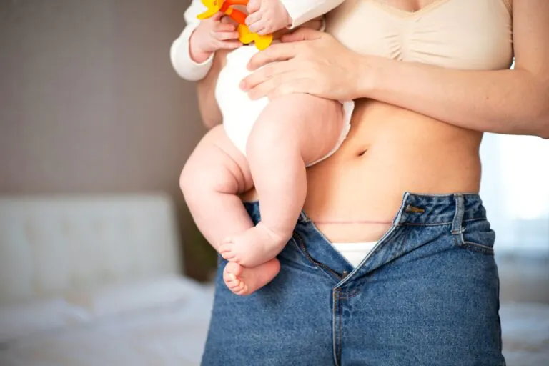 सिजेरियन डिलीवरी के कितने दिन बाद पीरियड आता है