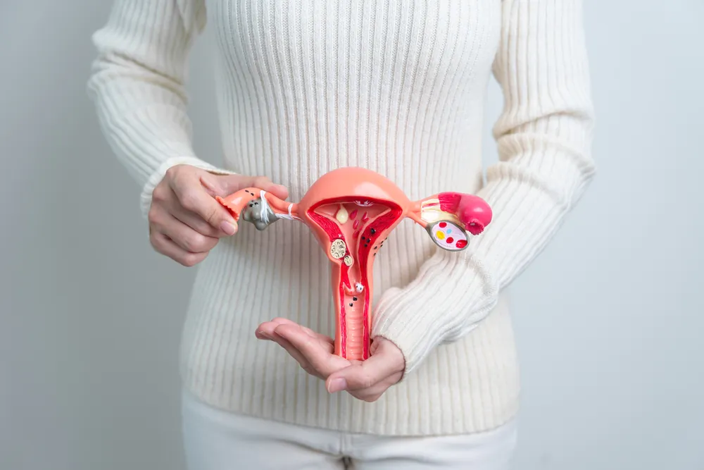 गर्भाशय में रसौली - लक्षण, कारण और इलाज